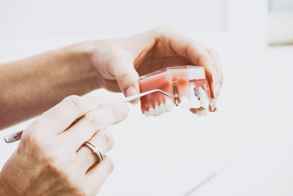dentist showing an implant