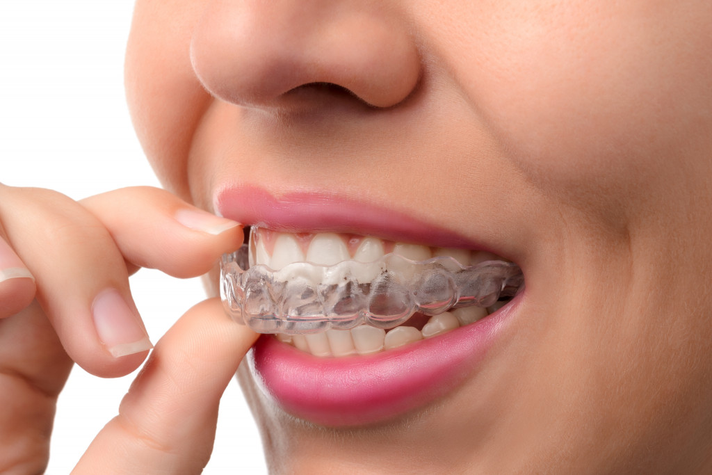 invisalign dental solution