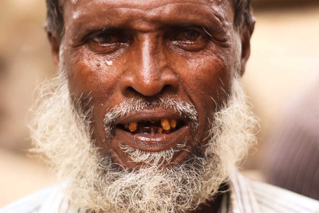 An Elderly Man with Crooked Teeth Smiling at the Camera