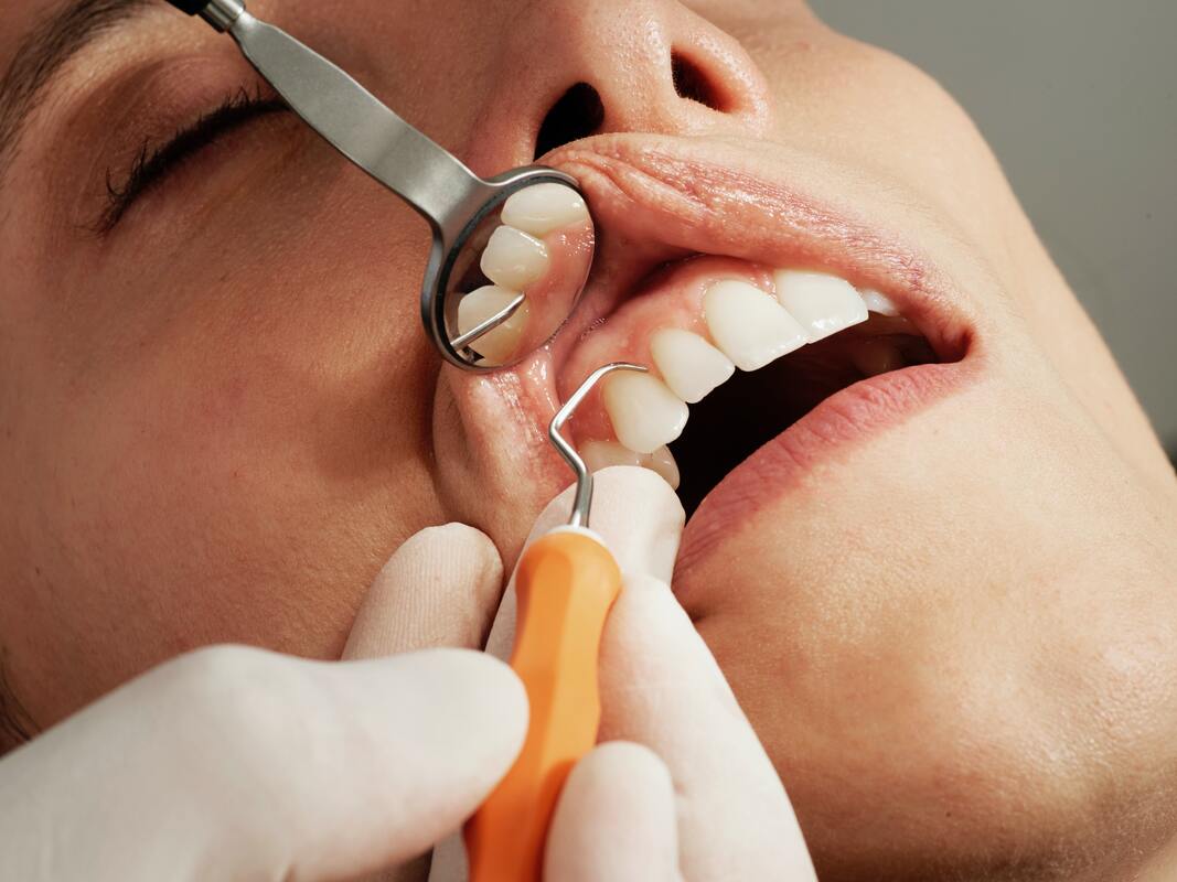 dentist checking up patient's gums